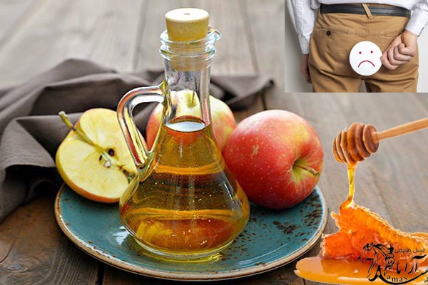 ترکیب سرکه سیب و موم عسل برای درمان بواسیر
