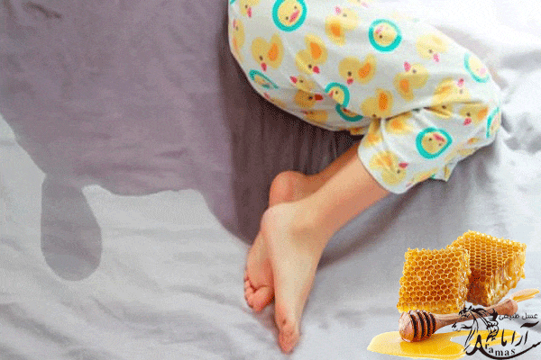 درمان شب ادراری کودکان با عسل